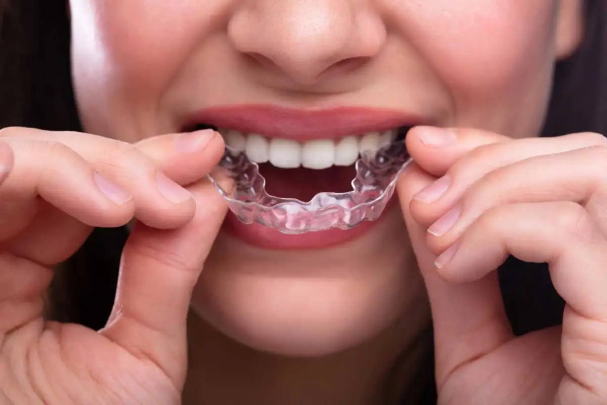 woman putting in her new Invisalign aligners